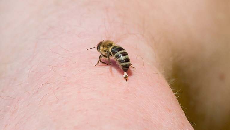 méhek ízületi gyulladás kezelése)